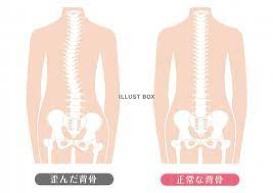 背骨の歪み矯正で改善する四十肩・五十肩