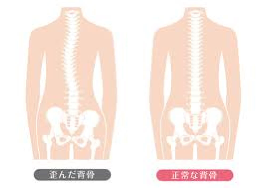 腰椎ヘルニア・頚椎ヘルニアになる椎間板の損傷