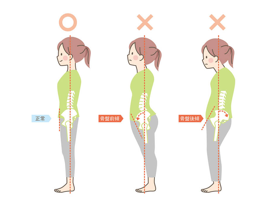 猫背矯正の日常ケア方法