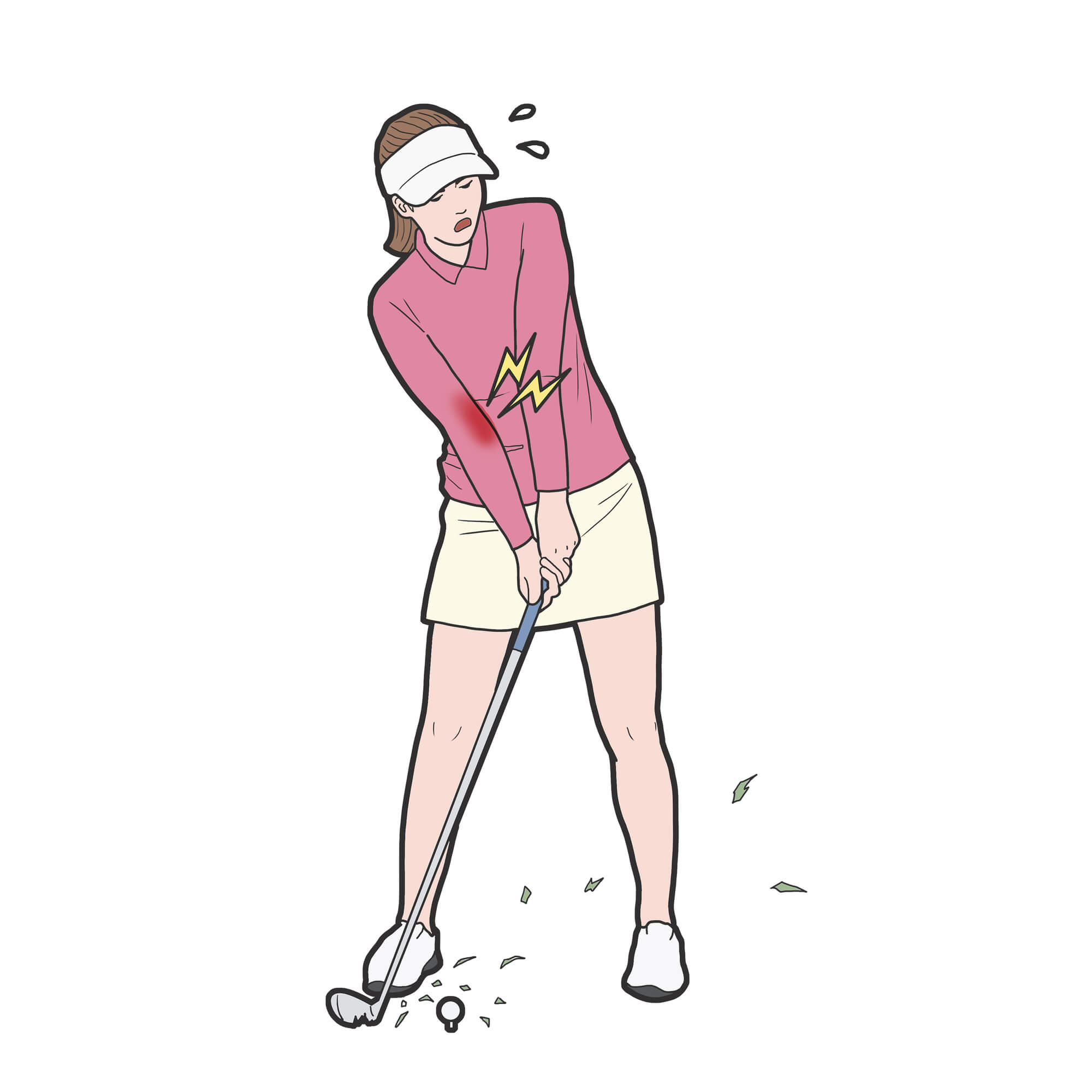 ゴルフ肘のイメージ