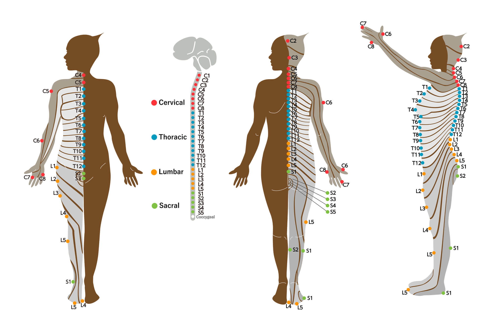 ぎっくり腰とヘルニアの症状・原因の違い